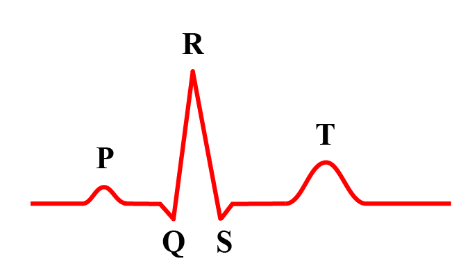 The typical electrocardiogram